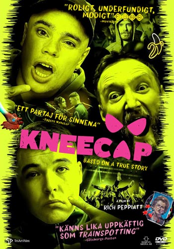 Kneecap