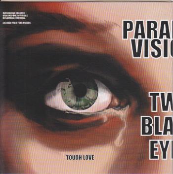 Two Black Eyes