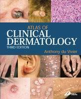 Atlas Of Clinical Dermatology