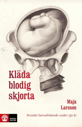 Kläda Blodig Skjorta - Svenskt Barnafödande Under 150 År