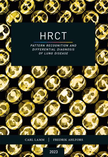 Hrct - Pattern Recognition And Differential Diagnosis Of Lung Disease